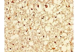 IHC image of ABIN7176635 diluted at 1:200 and staining in paraffin-embedded human brain tissue performed on a Leica BondTM system.