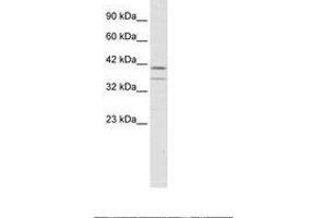 Image no. 1 for anti-CCAAT/enhancer Binding Protein (C/EBP), beta (CEBPB) (AA 239-288) antibody (ABIN6735936) (CEBPB antibody  (AA 239-288))
