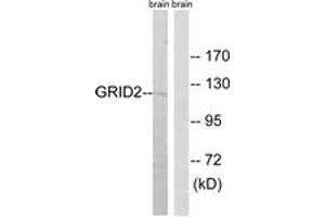 Western Blotting (WB) image for anti-Glutamate Receptor, Ionotropic, delta 2 (GRID2) (AA 831-880) antibody (ABIN2889966) (GRID2 antibody  (AA 831-880))