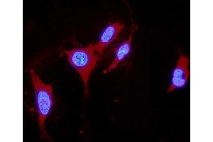 IF analysis of DDAH1 using anti-DDAH1 antibody (ABIN4886560). (DDAH1 antibody  (C-Term))