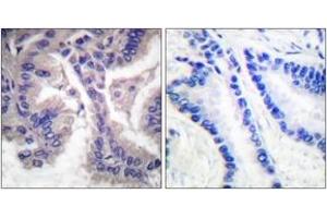 Immunohistochemistry (IHC) image for anti-Caspase 6, Apoptosis-Related Cysteine Peptidase (CASP6) (AA 144-193), (Cleaved-Asp162) antibody (ABIN2891156) (Caspase 6 antibody  (Cleaved-Asp162))