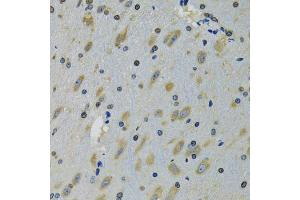 Immunohistochemistry of paraffin-embedded mouse brain using RPS12 antibody (ABIN5973491) at dilution of 1/100 (40x lens). (RPS12 antibody)