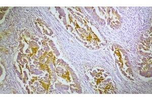 Image no. 1 for anti-Carcinoembryonic Antigen Gene Family (CEA) antibody (ABIN335404)