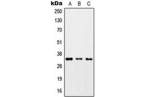 Western blot analysis of ZC3H8 expression in HepG2 (A), Raw264. (ZC3H8 antibody  (Center))