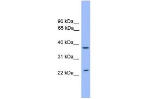 WB Suggested Anti-STX4 Antibody Titration: 0. (Syntaxin 4 antibody  (Middle Region))