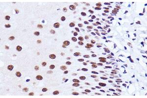 Immunohistochemistry of paraffin-embedded Human esophageal using MATR3 Polyclonal Antibody at dilution of 1:100 (40x lens). (MATR3 antibody)
