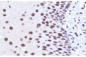 Immunohistochemistry of paraffin-embedded Human esophageal using MATR3 Polyclonal Antibody at dilution of 1:100 (40x lens).
