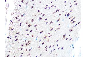 Immunohistochemistry of paraffin-embedded mouse brain using TPPP/p25 Rabbit mAb (ABIN7271031) at dilution of 1:100 (40x lens). (Tppp antibody)
