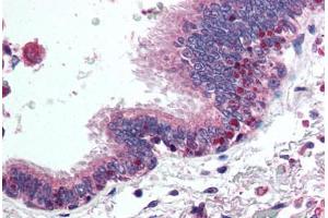 Human Lung, Respiratory Epithelium (formalin-fixed, paraffin-embedded) stained with HDAC4 antibody ABIN294416 at 5 ug/ml followed by biotinylated goat anti-rabbit IgG secondary antibody ABIN481713, alkaline phosphatase-streptavidin and chromogen. (HDAC4 antibody  (AA 194-209))