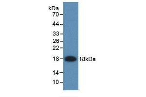 Detection of Recombinant FABP2, Rat using Monoclonal Antibody to Fatty Acid Binding Protein 2, Intestinal (FABP2) (FABP2 antibody  (AA 2-132))