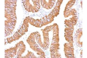 IHC-P Image CES2 antibody detects CES2 protein at cytosol on human colon by immunohistochemical analysis. (CES2 antibody)