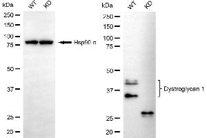 Western blotting analysis using dystroglycan 1 antibody (ABIN7798412). (Recombinant Dystroglycan antibody)