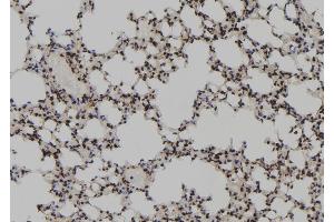 ABIN6267181 at 1/100 staining Mouse lung tissue by IHC-P.