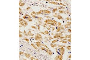 Antibody staining EGF in Human heart tissue sections by Immunohistochemistry (IHC-P - paraformaldehyde-fixed, paraffin-embedded sections).