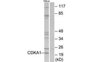 Western blot analysis of extracts from HeLa cells, using CDKPA1 Antibody. (CDK2AP1 antibody  (AA 51-100))