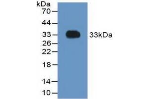 Detection of Recombinant F2, Rat using Polyclonal Antibody to Coagulation Factor II (F2) (Prothrombin antibody  (AA 324-617))