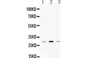 Western blot analysis of HLA-DPB1 expression in rat spleen extract ( Lane 1), mouse spleen extract ( Lane 2) and JURKAT whole cell lysates ( Lane 3).