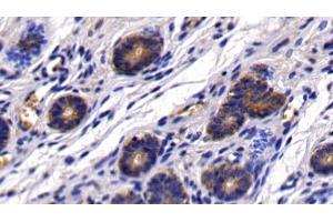 #VALUE! (HBEGF antibody  (AA 21-160))