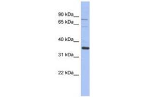 Image no. 1 for anti-NRBP2 (NRBP2) (AA 422-471) antibody (ABIN6744325) (NRBP2 antibody  (AA 422-471))