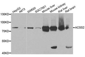 Western blot analysis of extracts of various cell lines, using ACSS2 antibody. (ACSS2 antibody)