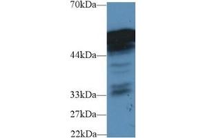 Detection of FGB in Mouse Liver lysate using Polyclonal Antibody to Fibrinogen Beta Chain (FGB)