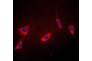 Immunofluorescent analysis of Cyclophilin F staining in K562 cells. (PPIF antibody  (Center))