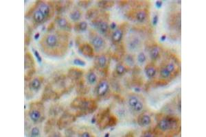 Used in DAB staining on fromalin fixed paraffin-embedded Liver tissue (SSFA2 antibody  (AA 276-510))