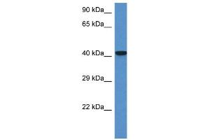 WB Suggested Anti-Zfp759 Antibody   Titration: 1. (Zfp759 antibody  (N-Term))