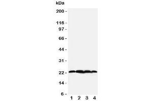 Western blot testing of BAG2 antibody;  Lane 1: rat testis;  2: HeLa;  3: A549;  4: A431 cell lysate. (BAG2 antibody  (N-Term))