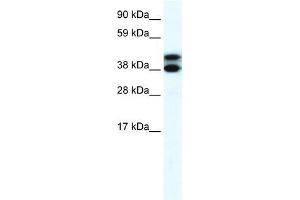 Human Lung; WB Suggested Anti-RFP2 Antibody Titration: 0. (TRIM13 antibody  (Middle Region))