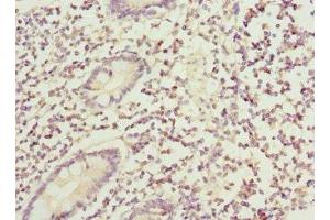 Immunohistochemistry of paraffin-embedded human small intestine tissue using ABIN7145556 at dilution of 1:100 (BFAR antibody  (AA 1-140))