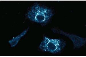 Immunofluorescence staining of HeLa cells (Human cervical epitheloid carcinoma, ATCC CCL-2. (HSP70 antibody  (AA 429-640))