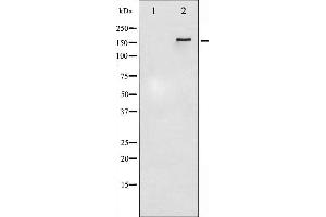 Western blot analysis of HER4 phosphorylation expression in EGF treated HuvEc whole cell lysates,The lane on the left is treated with the antigen-specific peptide. (ERBB4 antibody  (pTyr1284))