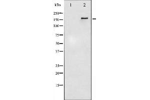 Western blot analysis of HER4 phosphorylation expression in EGF treated HuvEc whole cell lysates,The lane on the left is treated with the antigen-specific peptide. (ERBB4 antibody  (pTyr1284))