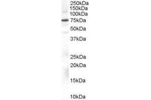 Western Blotting (WB) image for anti-Adrenergic, Beta, Receptor Kinase 1 (ADRBK1) (AA 319-331) antibody (ABIN296681) (GRK2 antibody  (AA 319-331))