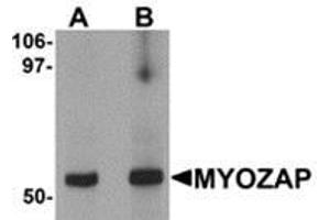 Western blot analysis of MYOZAP in rat kidney tissue lysate with MYOZAP antibody at (A) 1 and (B) 2 μg/ml.