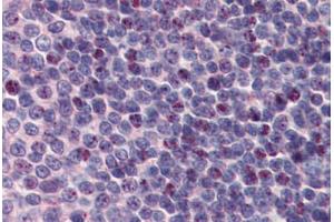 Human Spleen: Formalin-Fixed, Paraffin-Embedded (FFPE) (PCBP1 antibody  (AA 208-257))