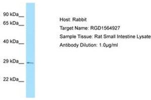 Image no. 1 for anti-TGFB-Induced Factor Homeobox 2 (TGIF2) (C-Term) antibody (ABIN6749857) (TGIF2 antibody  (C-Term))