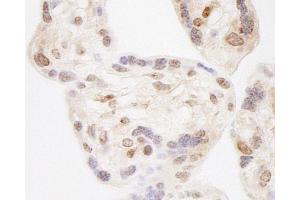 Immunohistochemistry (IHC) image for anti-Wolf-Hirschhorn Syndrome Candidate 2 (WHSC2) (AA 499-549) antibody (ABIN7454795)
