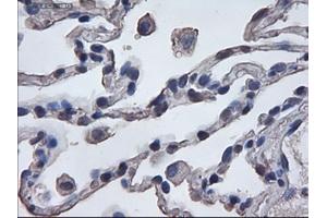 Immunohistochemical staining of paraffin-embedded lung using anti-ERK3 (TA000076) mouse monoclonal antibody. (MAPK6 antibody  (AA 345-721))