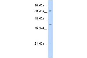 SWAP70 antibody used at 5 ug/ml to detect target protein. (SWAP70 antibody  (N-Term))