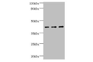 Western blot All lanes: Leukocyte elastase inhibitor antibody at 4 μg/mL Lane 1: MCF-7 whole cell lysate Lane 2: Hela whole cell lysate Lane 3: HepG2 whole cell lysate Secondary Goat polyclonal to rabbit IgG at 1/10000 dilution Predicted band size: 43, 27 kDa Observed band size: 43 kDa (SERPINB1 antibody  (AA 100-379))