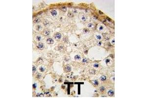 Formalin-fixed and paraffin-embedded human testis tissue reacted with DDX4 antibody (C-term) (ABIN388152 and ABIN2846906) , which was peroxidase-conjugated to the secondary antibody, followed by DAB staining. (DDX4 antibody  (C-Term))