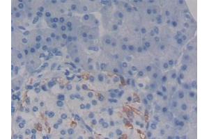 Detection of SDC1 in Human Pancreas Tissue using Polyclonal Antibody to Syndecan 1 (SDC1) (Syndecan 1 antibody  (AA 23-253))