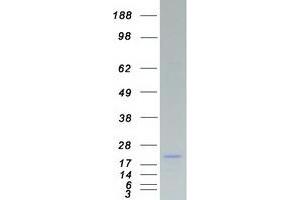 Validation with Western Blot (SSX2 Protein (Transcript Variant 2) (Myc-DYKDDDDK Tag))
