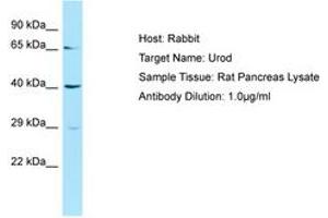 Image no. 1 for anti-Uroporphyrinogen Decarboxylase (UROD) (AA 51-100) antibody (ABIN6749872) (UROD antibody  (AA 51-100))