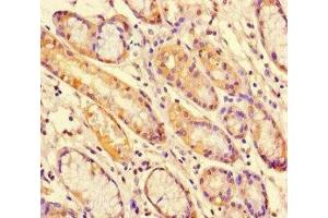 Immunohistochemistry (IHC) image for anti-Signal Transducer and Activator of Transcription 1, 91kDa (STAT1) (AA 63-196) antibody (ABIN7169664)