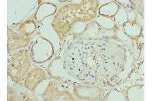 Immunohistochemistry of paraffin-embedded human kidney tissue using ABIN7156393 at dilution of 1:100 (INTS1 antibody  (AA 451-710))