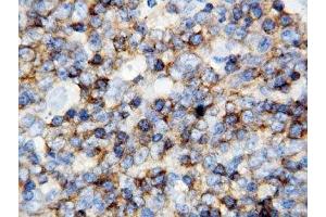Immunohistochemistry (IHC) image for anti-Protein tyrosine Phosphatase, Receptor Type, C (PTPRC) (AA 1209-1227) antibody (ABIN3032399)