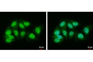 ICC/IF Image DDB1 antibody [N1N3] detects DDB1 protein at nucleus and cytoplasm by immunofluorescent analysis. (DDB1 antibody)